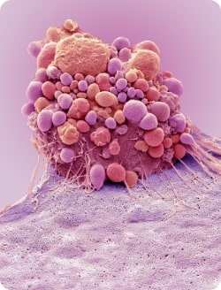 Cell apoptosis – brain cancer